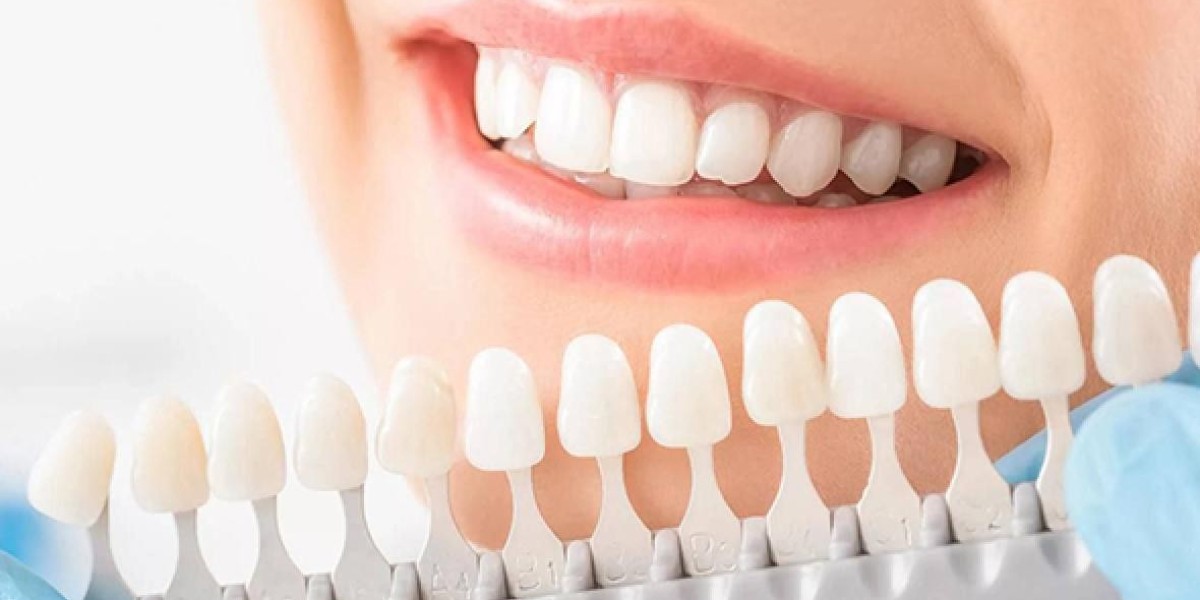 Rising Awareness of Dental Aesthetics to Propel Growth of the Global Dental Veneers Market