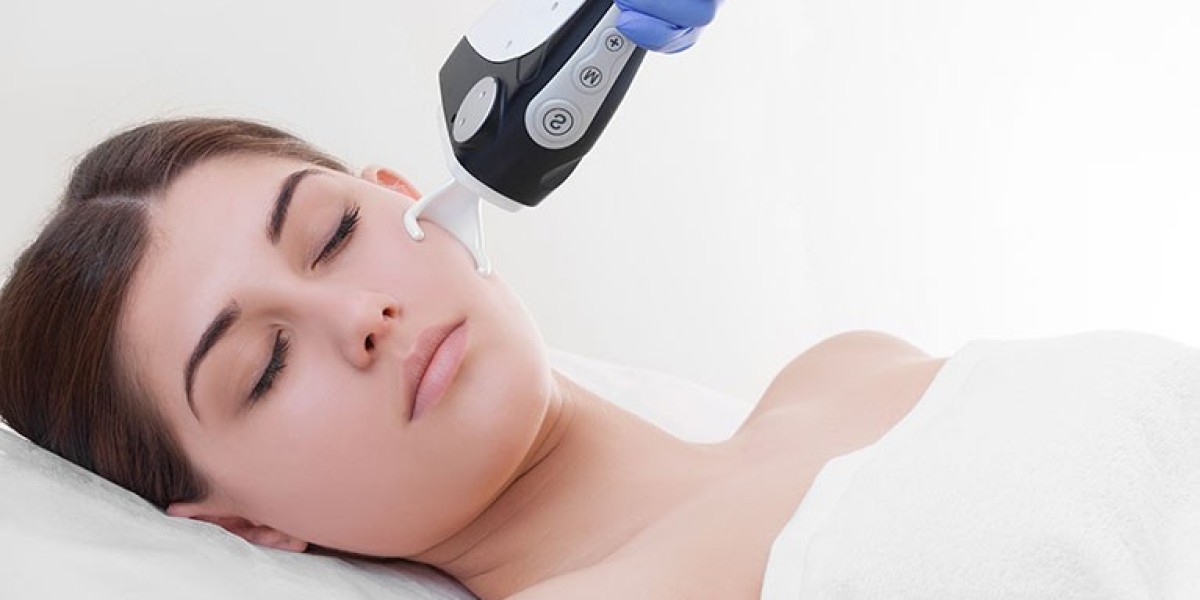 Fractional CO2 Laser for Hyperpigmentation: Riyadh Experts