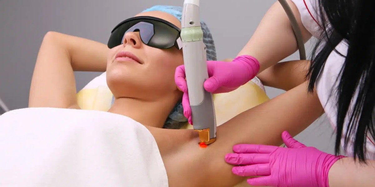 How Laser Hair Removal Helps with Hyperpigmentation