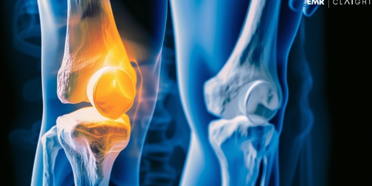 Global Biocompatible Coating Market
