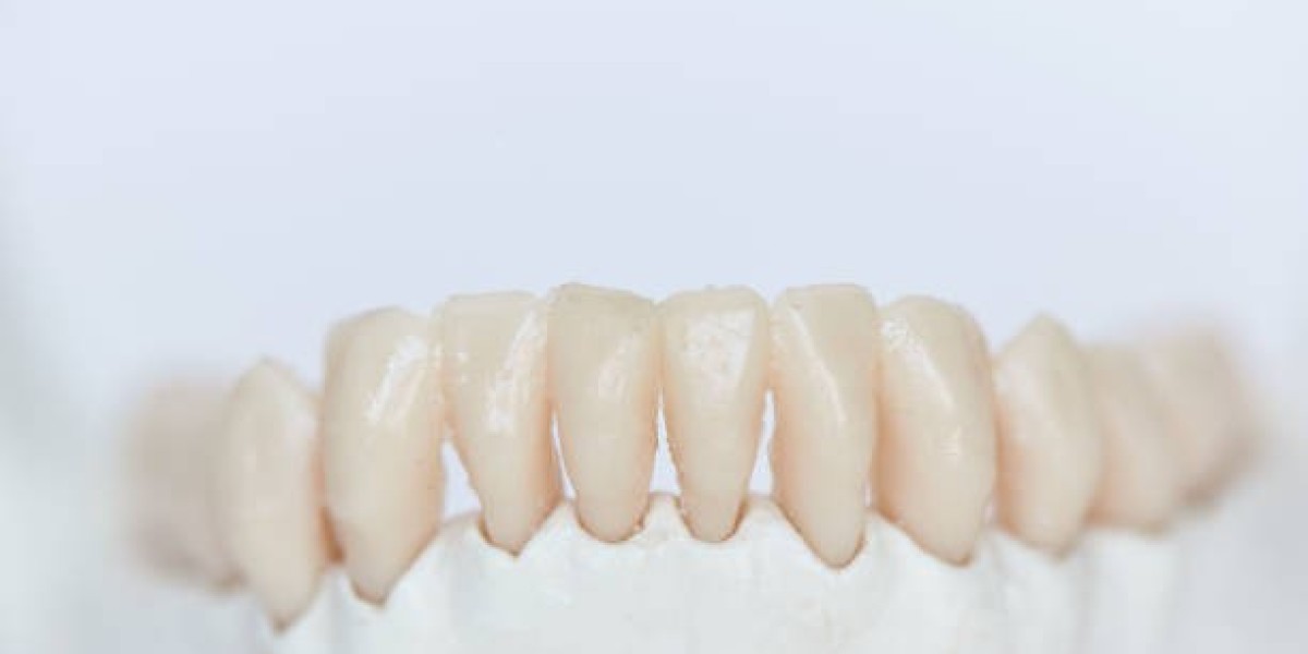 زركونيا كراون في الرياض: الحل لمشاكل الأسنان التجميلية