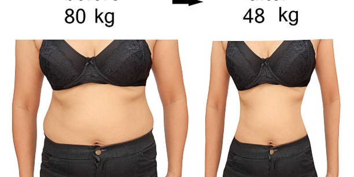 Transform Your Silhouette with 4D Vaser Liposuction in Riyadh