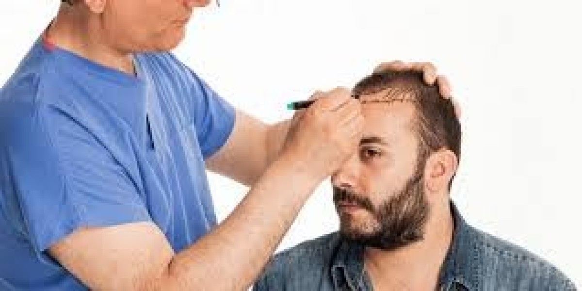 Get Back Your Hair with Advanced Transplant Solutions in Riyadh
