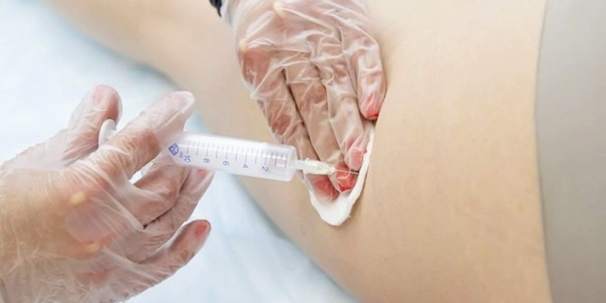 The Benefits of Fat-Dissolving Needles for Sculpting Your Body in Dubai