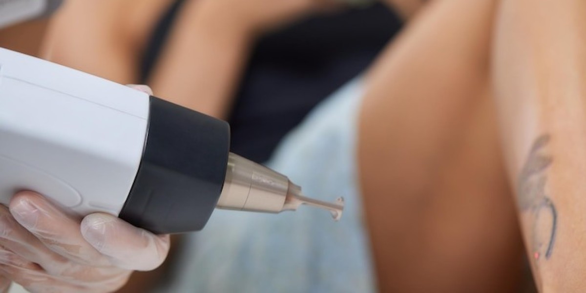 Can multiple tattoos be treated in one session?
