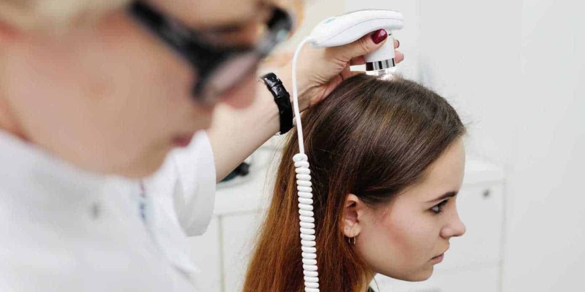 Women Hair Transplant In Bangalore