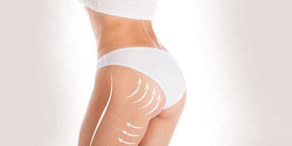 Affordable Brazilian Butt Lift Options in Riyadh