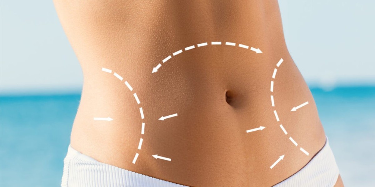 Key Factors to Consider Before Choosing a Tummy Tuck