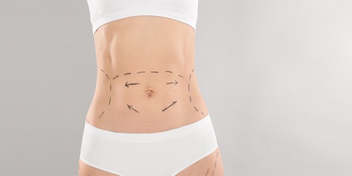 Understanding the Benefits and Risks of a Tummy Tuck Procedure