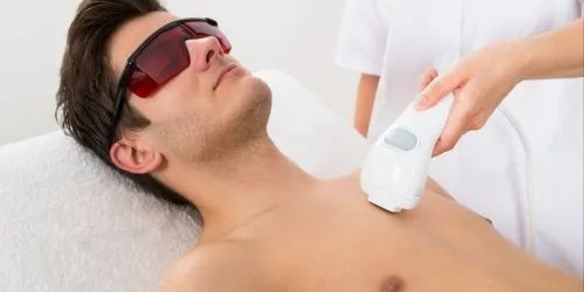 Male Laser Hair Removal for Different Areas: What You Need to Know