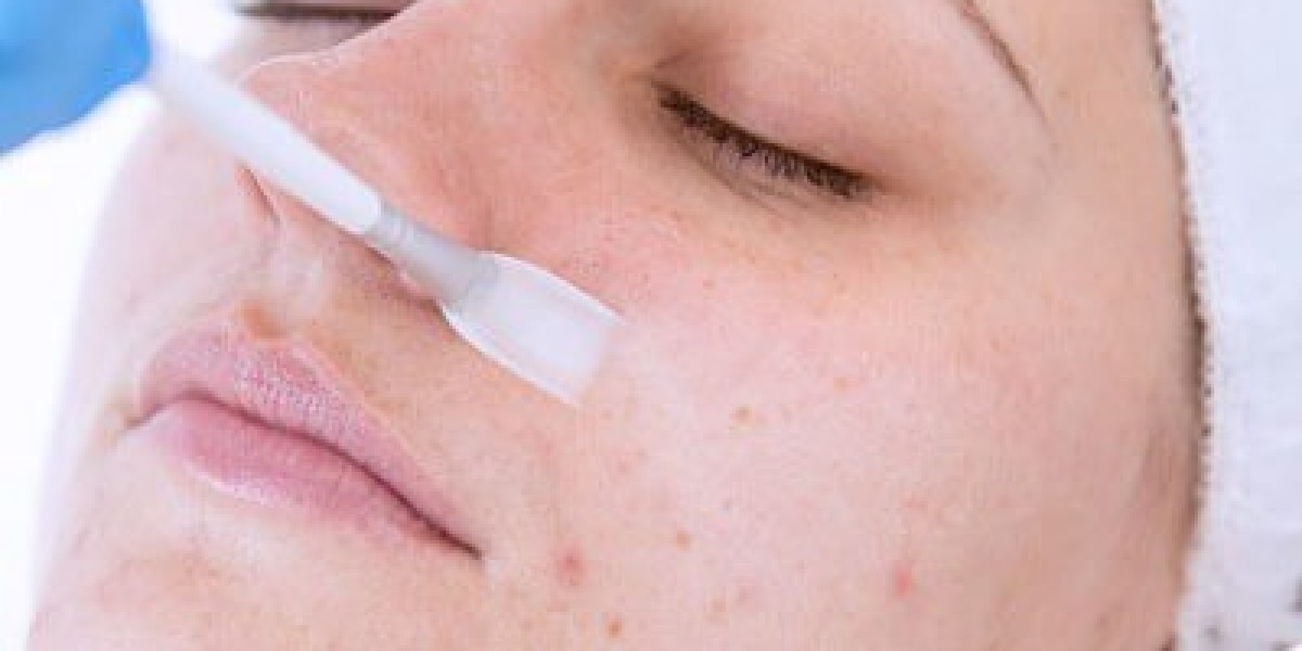 Chemical Peels in Dubai: Transform Your Skin from Dull to Dazzling