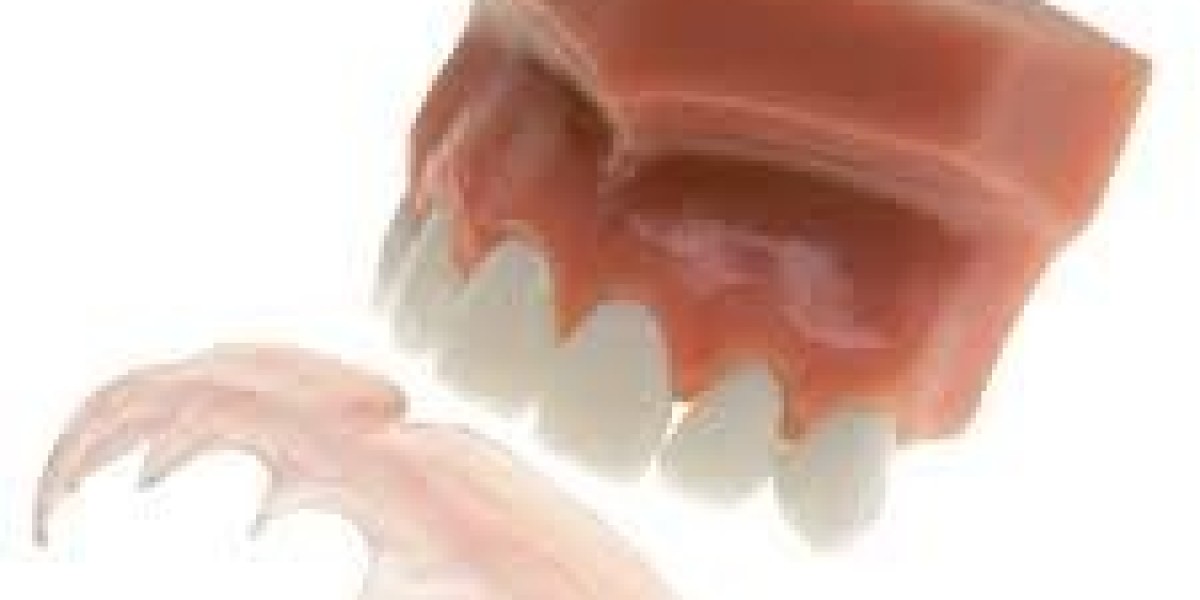 Transform Your Smile with a Custom Gingival Mask