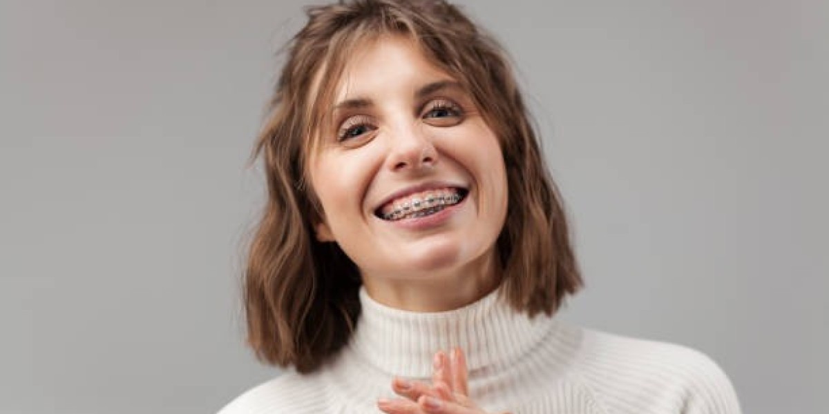 How Long Do Braces Take? Riyadh Experts Answer