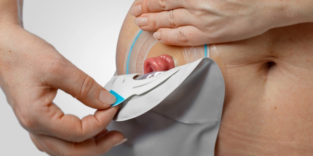Ostomy Devices Market: Exploring the Potential for Global Expansion