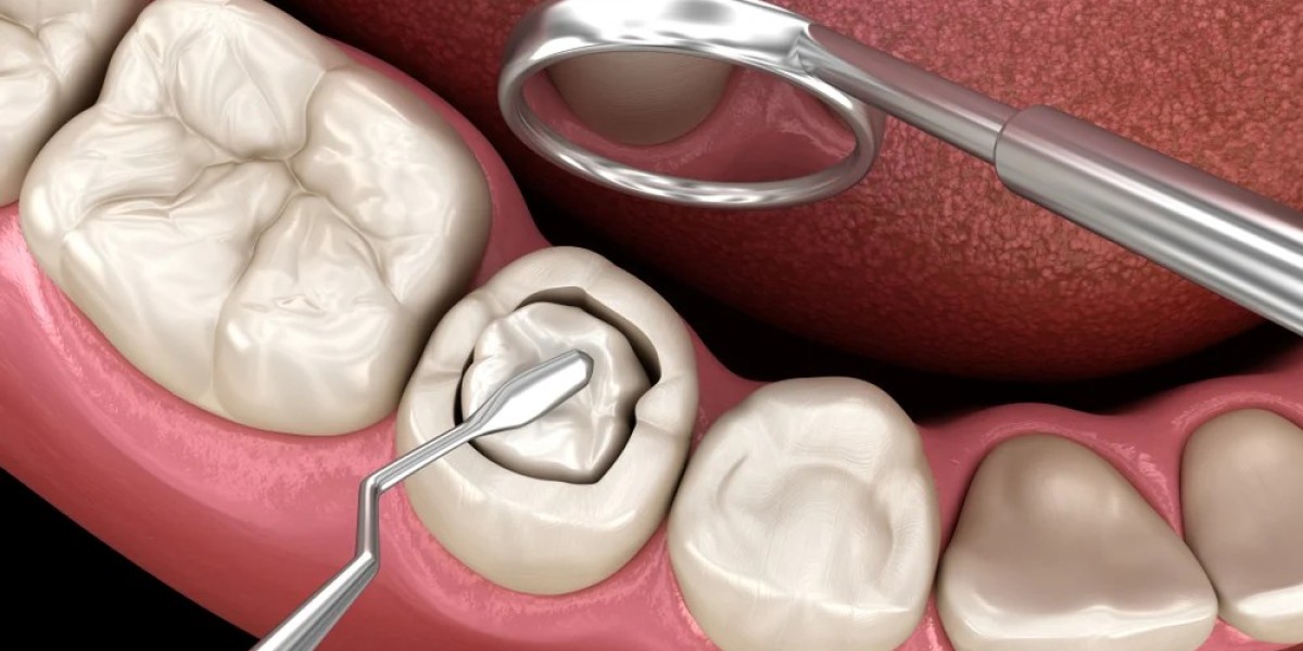 Dental Sealants Market: Rising Demand Driven by Preventive Care and Innovation