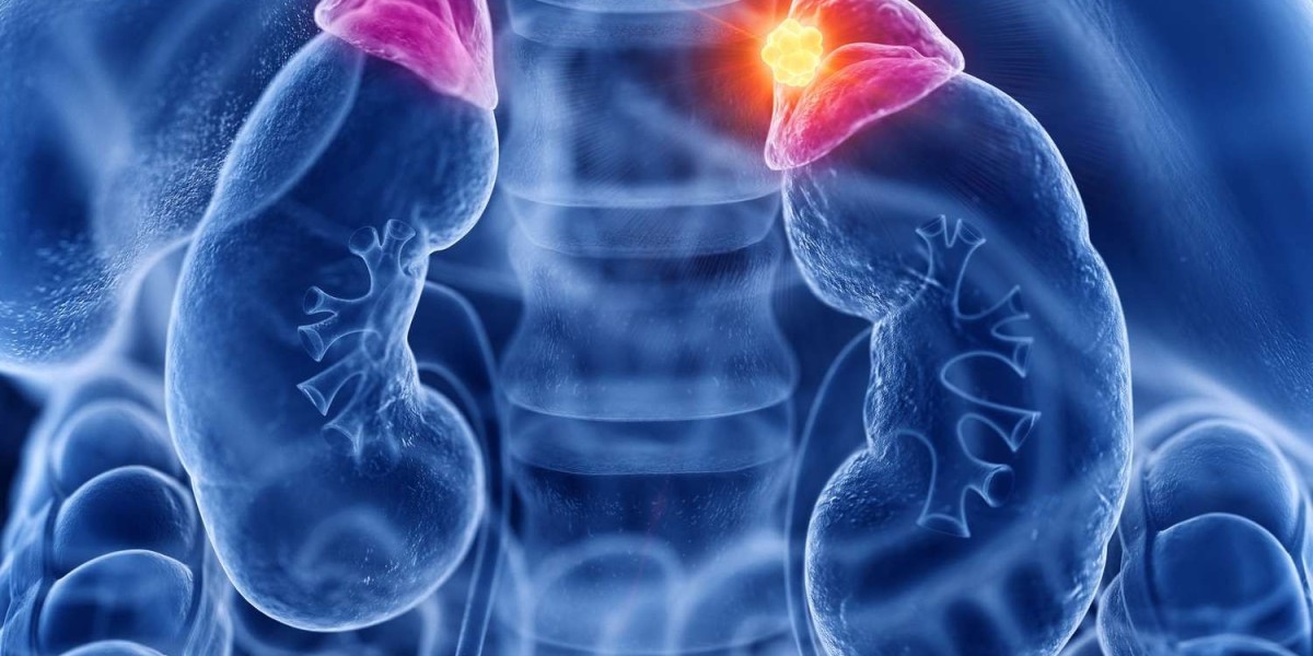 The Clinically Isolated Syndrome Market Poised For Continued Growth Owing To Increasing CIS Diagnosis