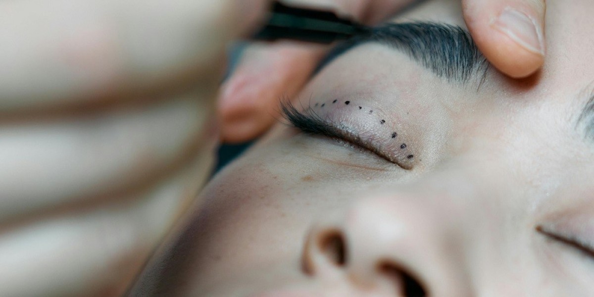 The Art of Eyelid Surgery at Glamorous Clinic: Precision and Perfection