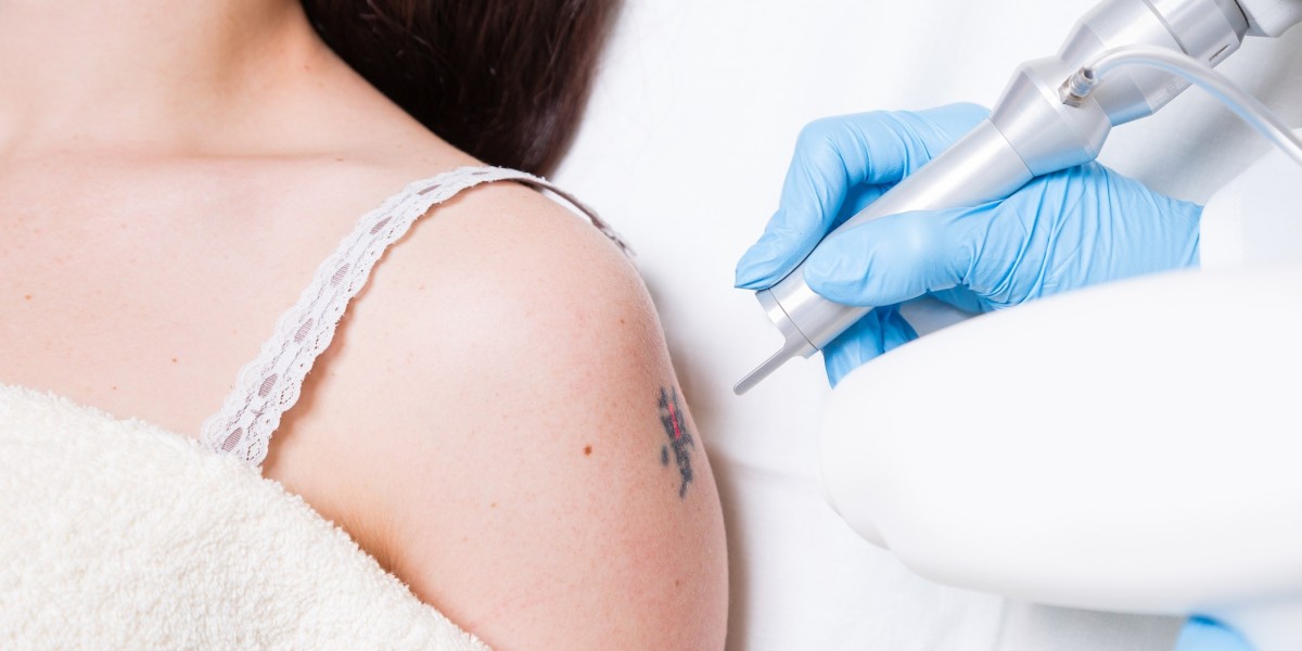 How to Improve Your Laser Tattoo Removal Results with Proper Care