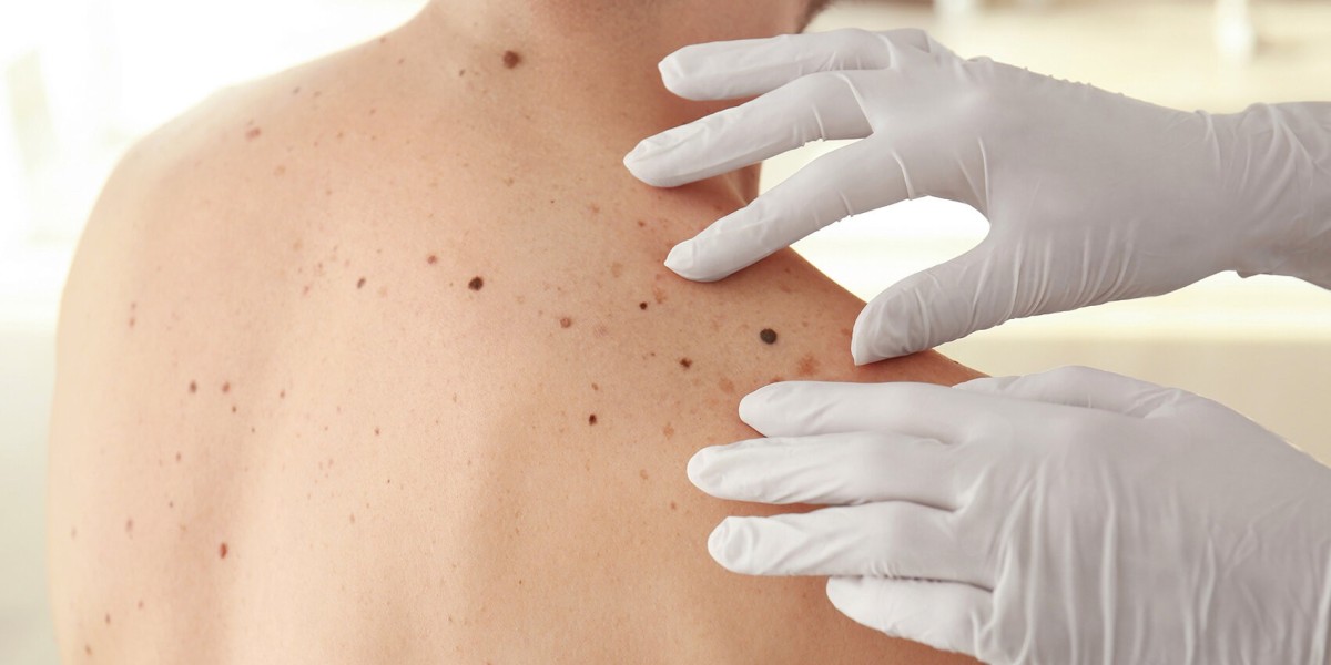 Why the Best Dermatologist Is Your Best Bet for Treating Persistent Skin Problems
