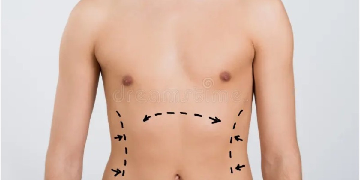 Is VASER liposuction right for you insights from Riyadh clinics