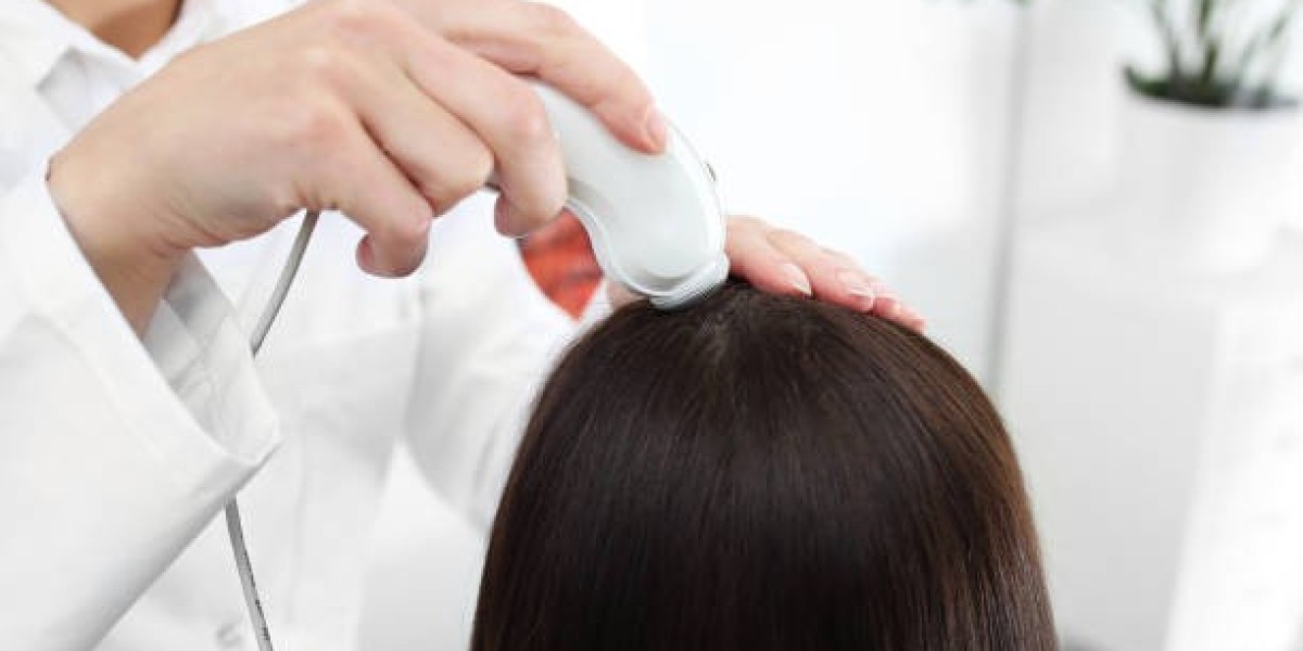 Hair Regrowth Results with Concentrated Growth Factor in Riyadh
