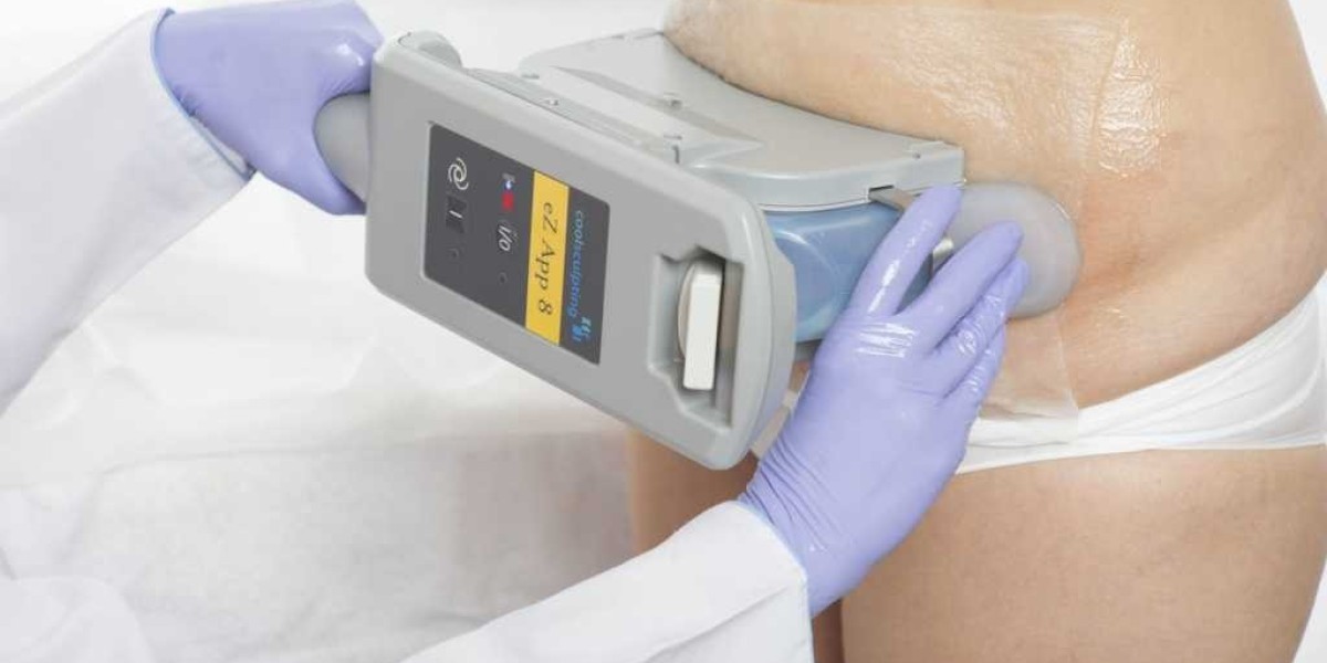 The Coolest Way to Sculpt Your Body: CoolSculpting