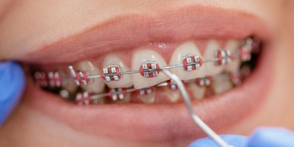 Orthodontics in Riyadh: Transform Your Smile in 2025