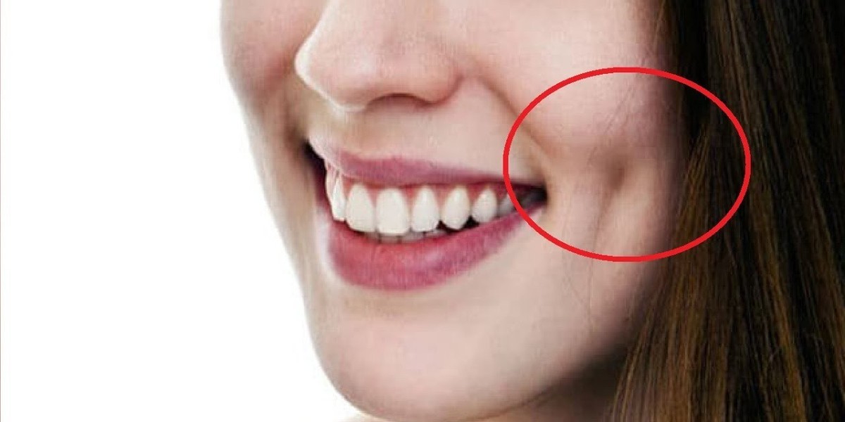 The Cost of Dimple Creation in Riyadh: What to Expect