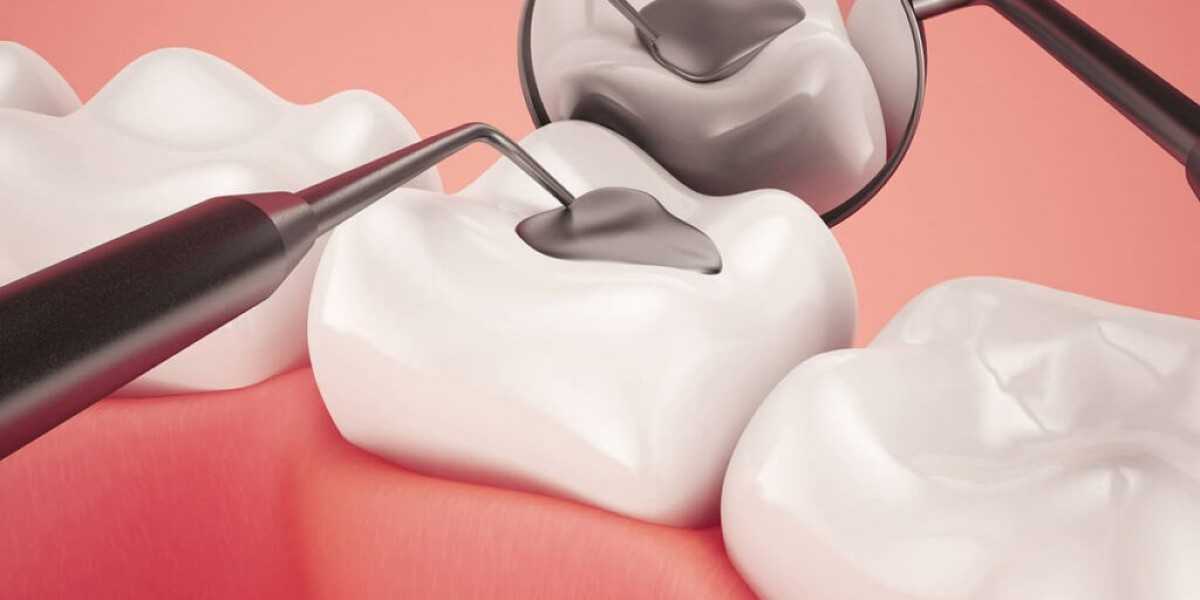 Dental Sealants Market Inhibitors: Challenges Impacting Growth and Adoption in Preventive Dentistry Worldwide