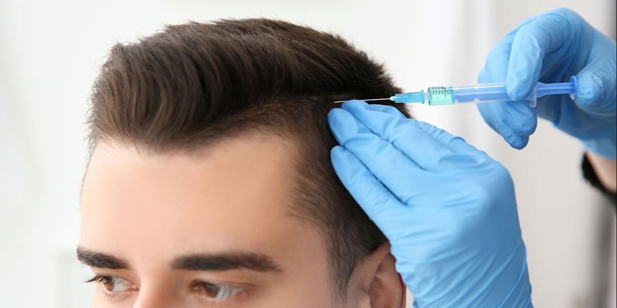 Is PRP Hair Treatment Effective for Female Hair Loss in Riyadh?