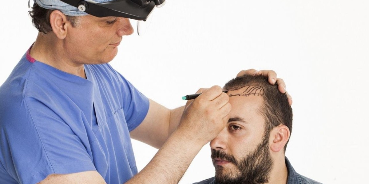 Top Mistakes to Avoid After Hair Transplant in Islamabad