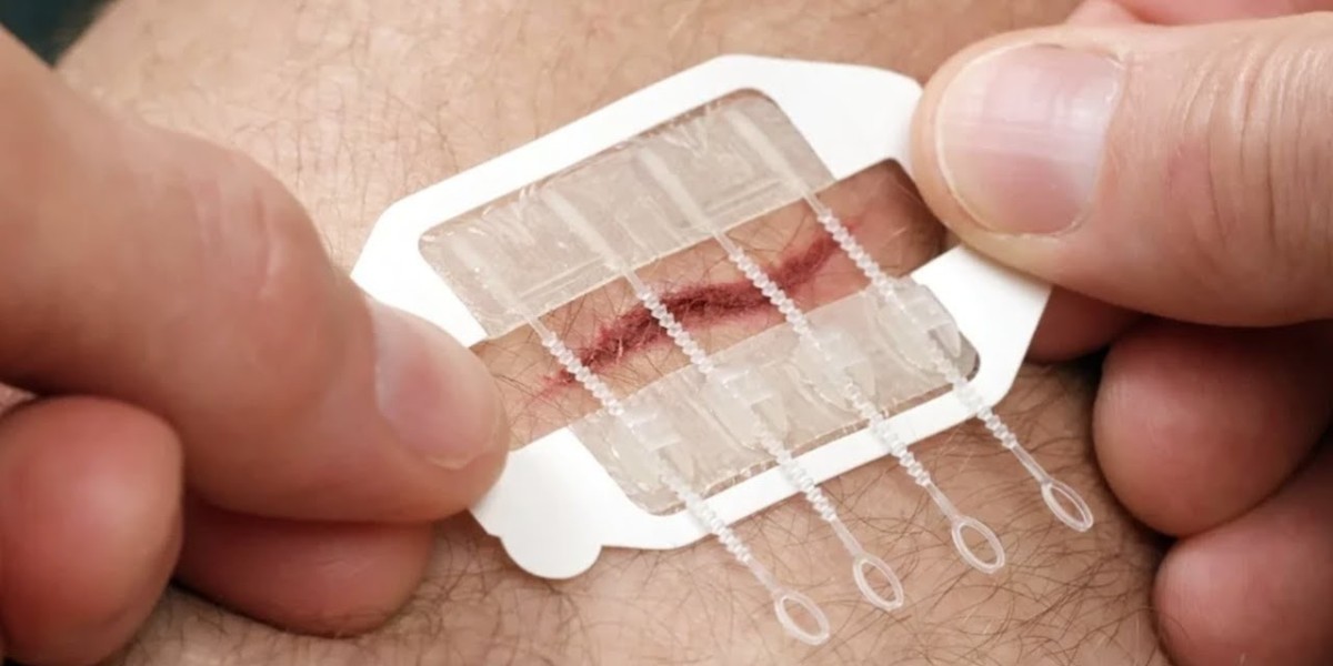 Non-invasive Surgical Wound Closure Market Strategies Strategic Partnerships and Collaborations