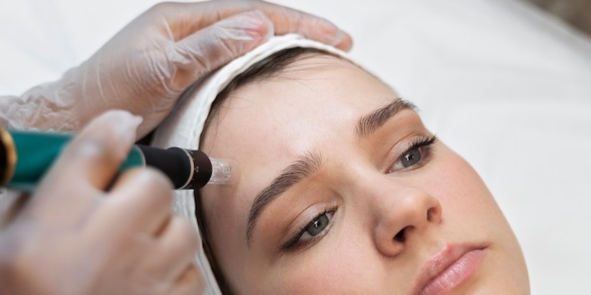 Can Microneedling Be Used on the Eyelids?