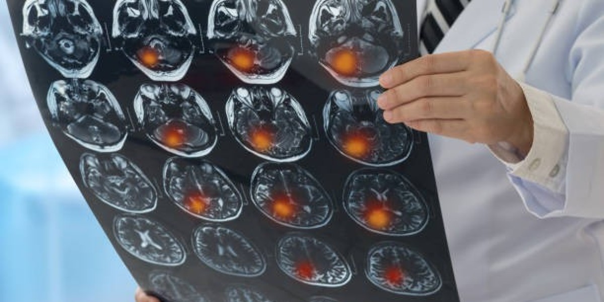 Fast Track to Effective Tumor Screening in Riyadh 2023