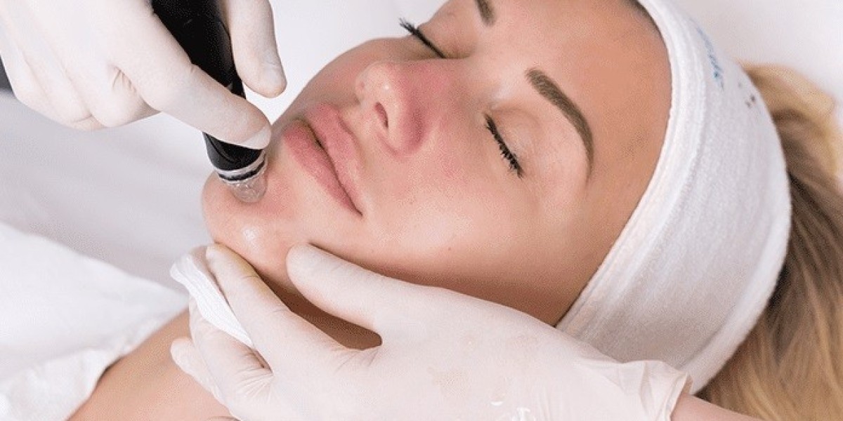 Who Can Benefit from Gynecomastia Surgery?