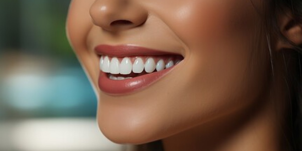 Hollywood Smile Dentistry Riyadh: A Step-by-Step Process