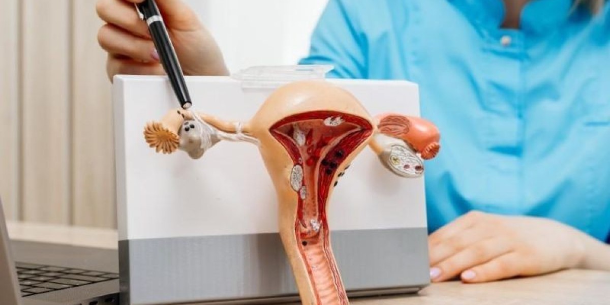 Understanding Endometriosis Treatment: What Works Best?
