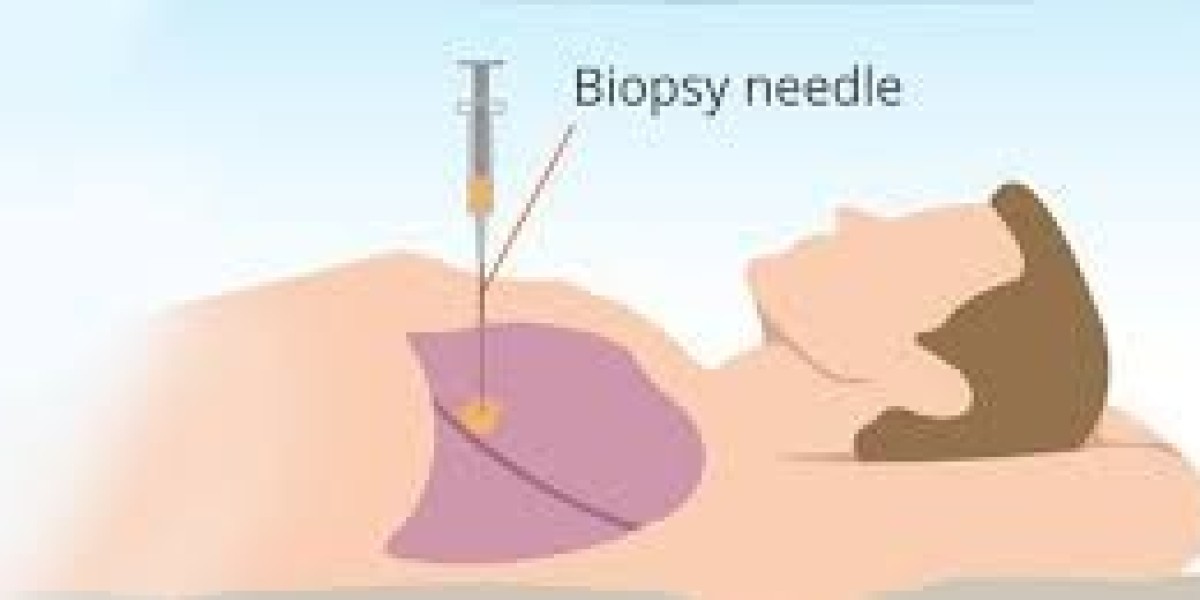 Biopsy for Diagnostic Purposes – Myths vs Facts