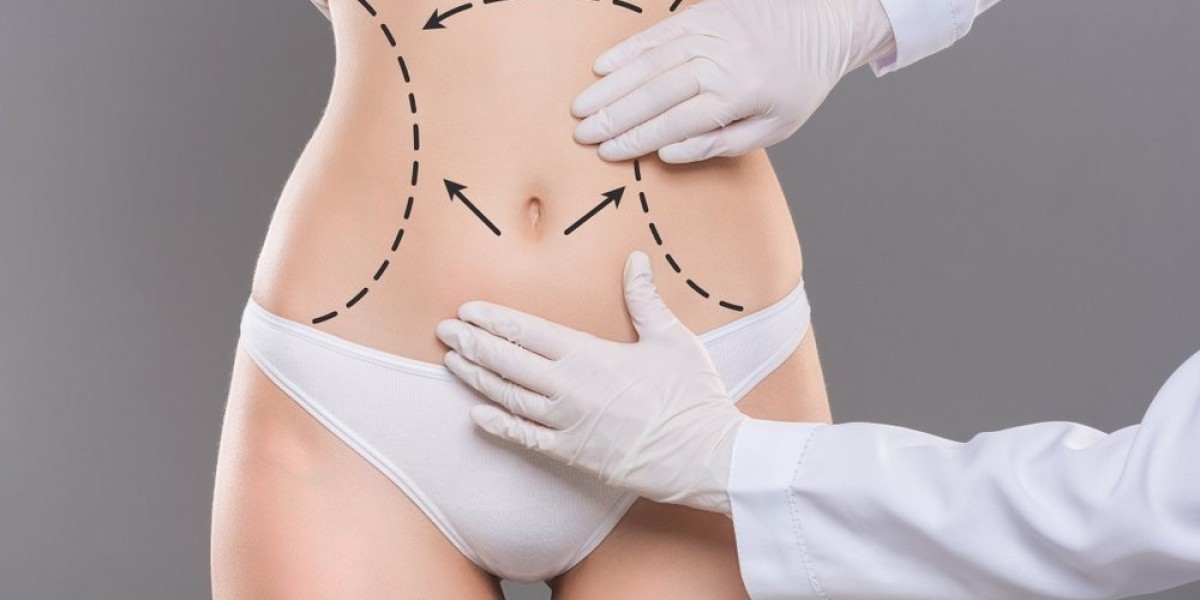 Sculpt Your Dream Body: Best Liposuction in Riyadh