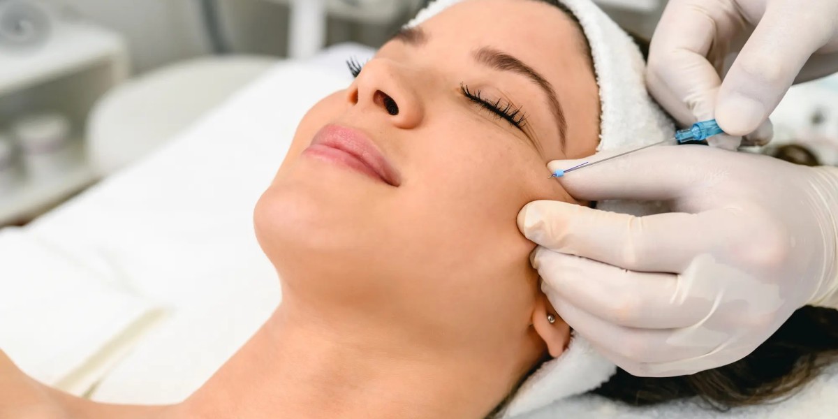 How Does Thread Lift Treatment Work for Nasolabial Folds?