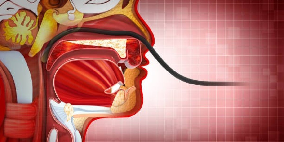 Nasogastric Intubation Market  Growth Unveiled: Strategic Future Insights 2024-2032
