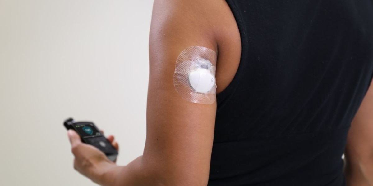 Glucose Sensors Market Pricing Strategies for Competitive Edge and Profit Maximization