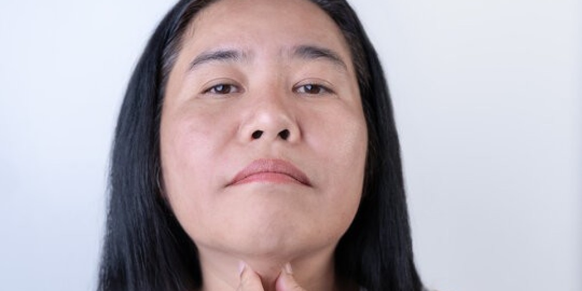Where Can I Get Non-Invasive Double Chin Liposuction?