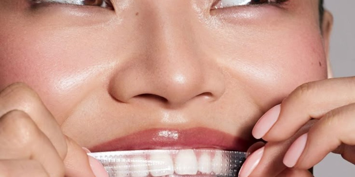 The Best Time to Use Teeth Whitening Strips in Riyadh