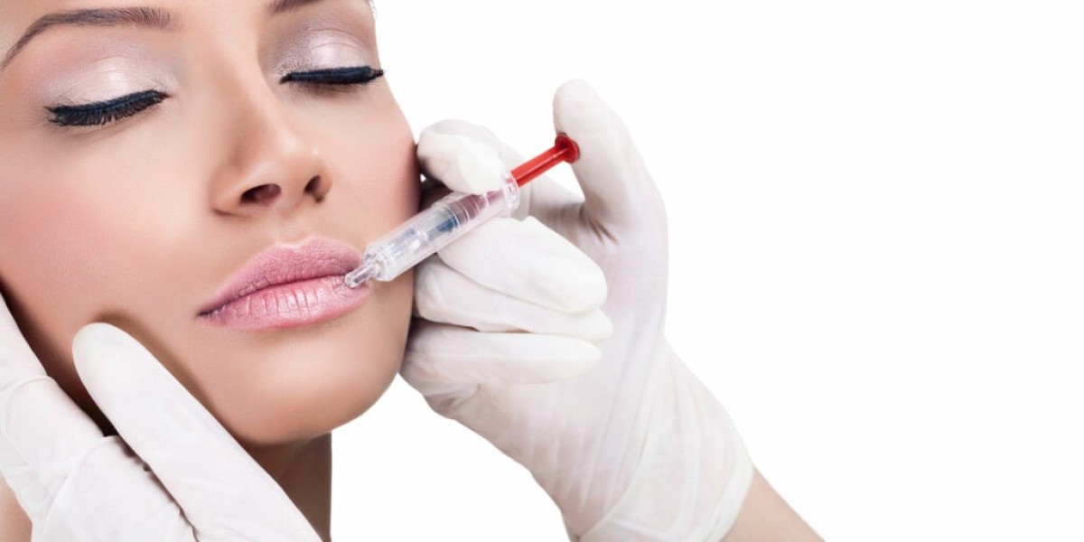 Lip Fillers Southampton: Everything You Need to Know Before Getting the Perfect Pout