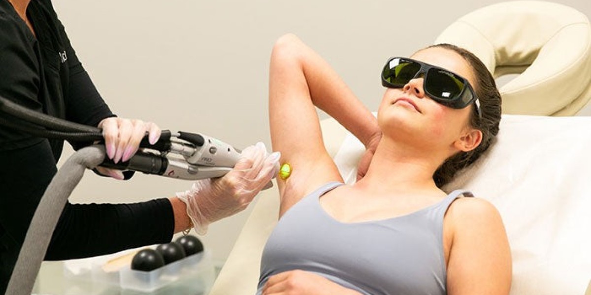 Is Laser Hair Removal Safe for Sunburned Skin