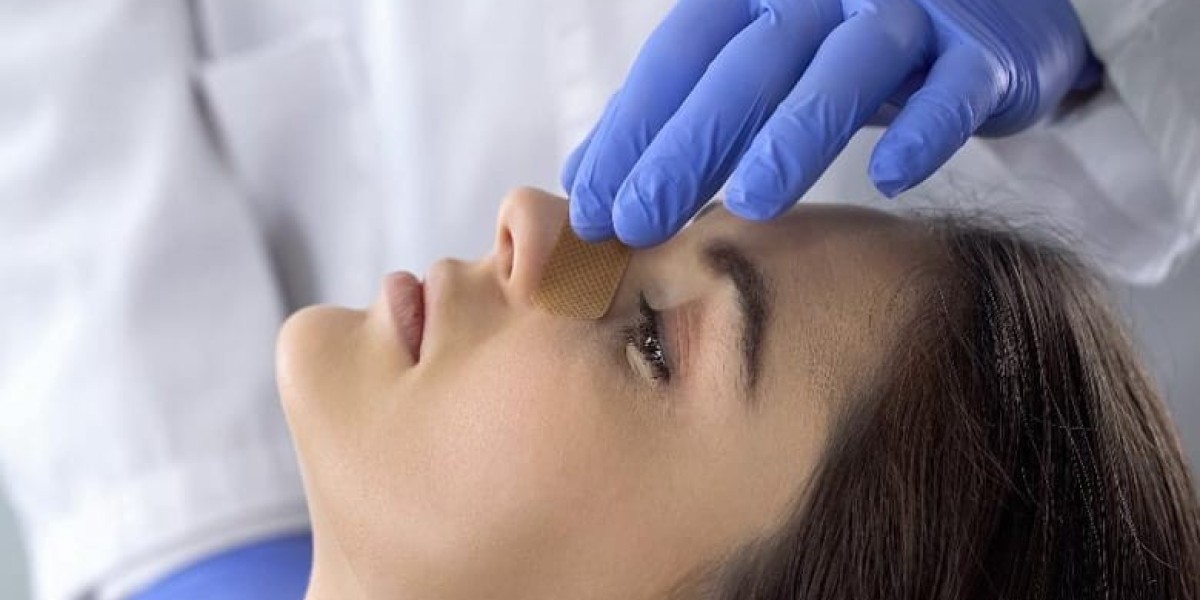 Minimally Invasive Rhinoplasty in Riyadh – Natural & Subtle Results