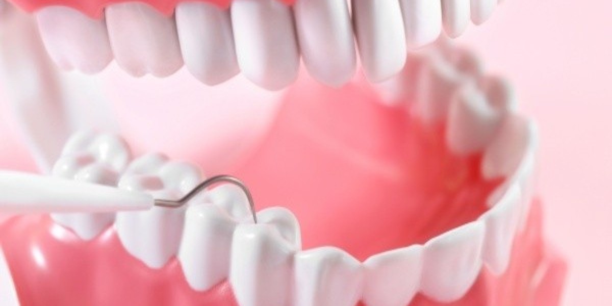 Răng khôn có phải nhổ không? Chuyên gia giải đáp