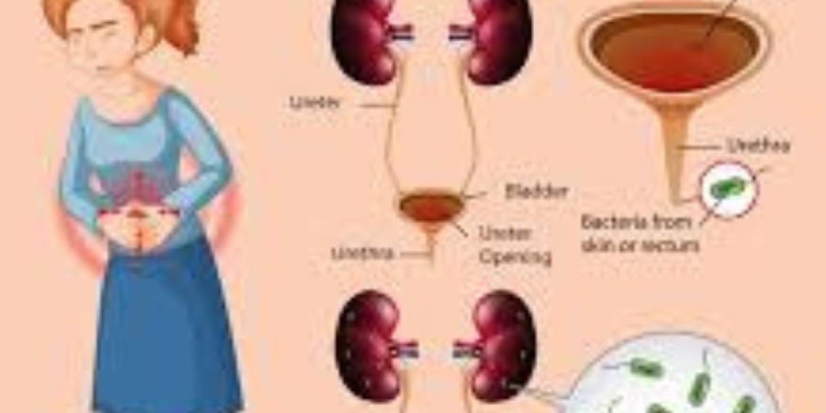 UTI Relief: The Best Over-the-Counter Medicine and Prescription Treatments