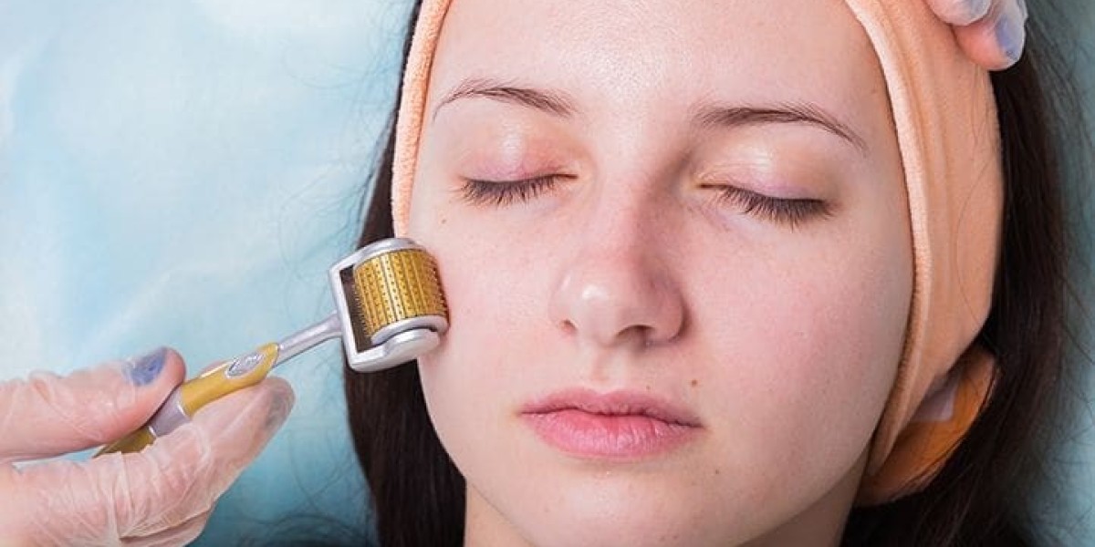 Revitalize Your Skin with Microneedling in Southampton